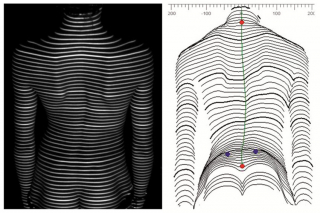 Formetric 4D - Diagramm